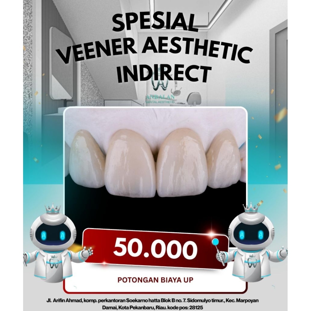 Penambalan  Gigi Depan Veener Indirect