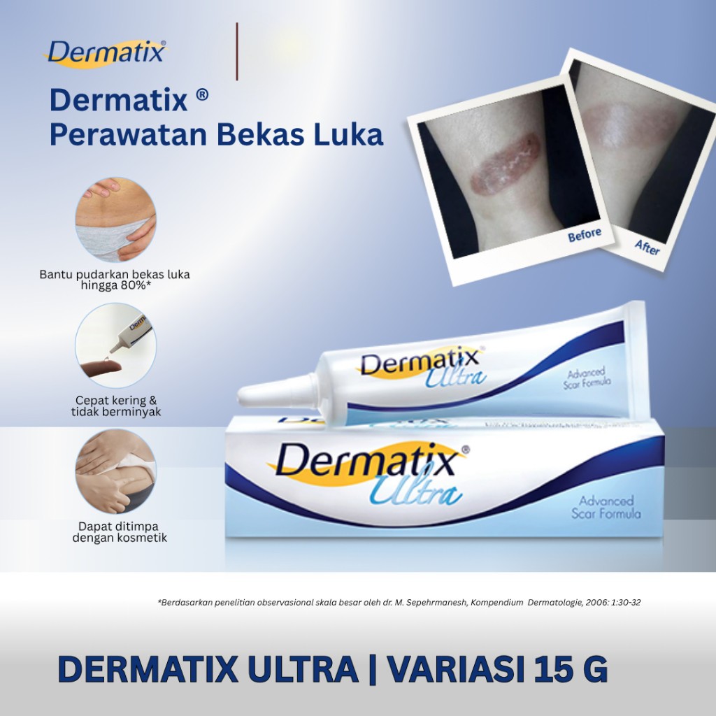 Dermatix Ultra ORIGINAL Membantu Menghilangkan Bekas Luka