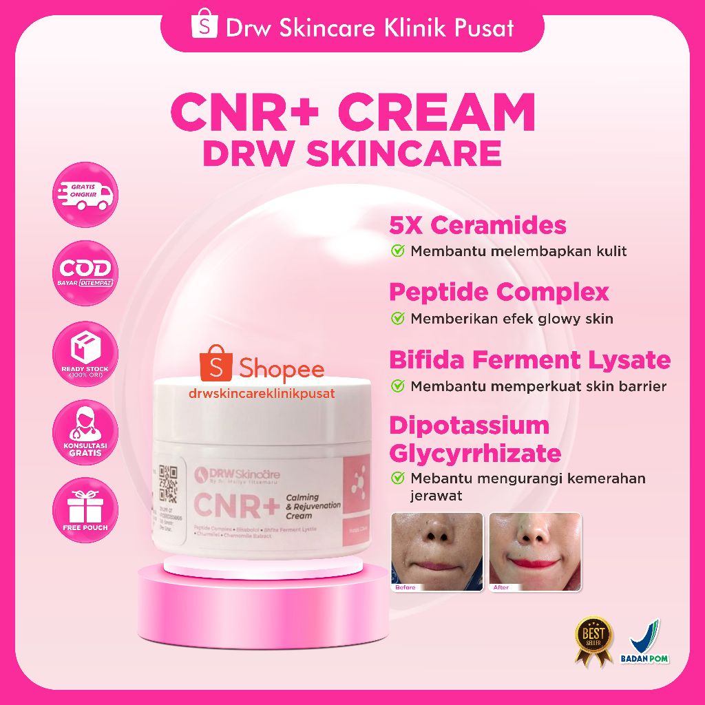 DRW Skincare CNR+ Relief dan Rejuvenation Cream bantu Atasi Kulit Sensitif dan Dermatitis