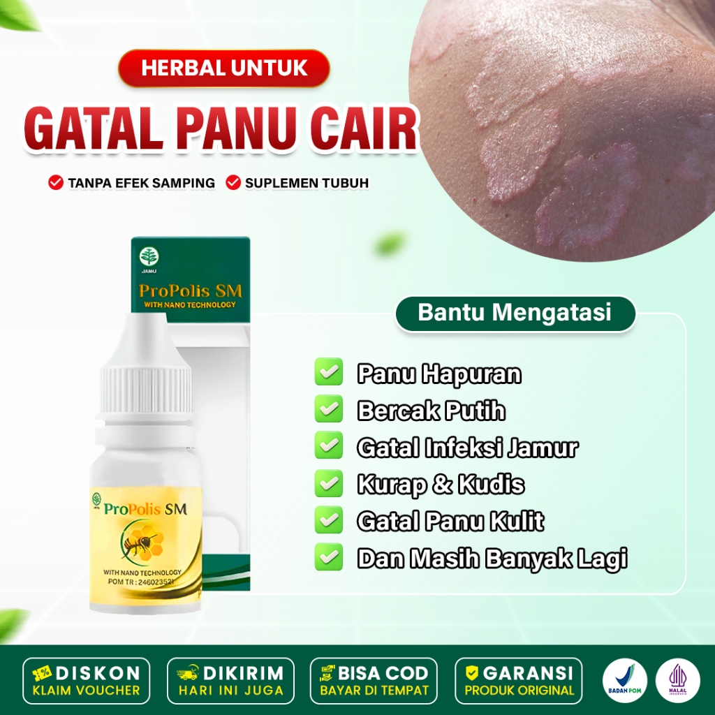 Obat Panu Cair - Obat Pengilang Panu Bercak Putih Di Kulit - Herbal Panu Infeksi Jamur Kurap Kudis