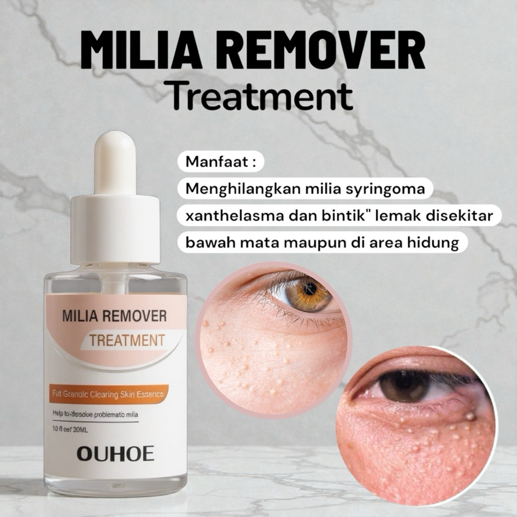 Milia Remover Serum Penghilang Perontok Milia Bintik Putih Mata Ouhoe Milia Remover Treatment Oil-Fr