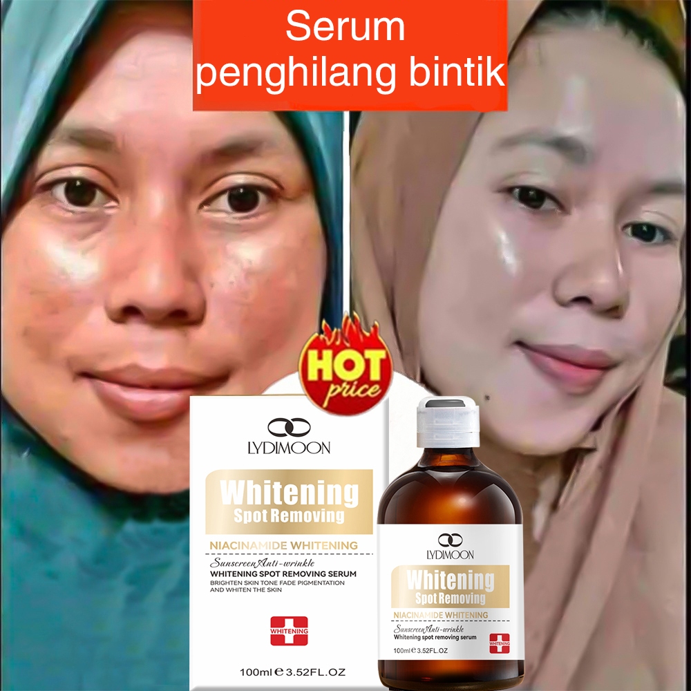 Serum flek hitam Serum mencerahkan wajah Cream penghilang flek hitam Serum anti aging 100ML Whitenin