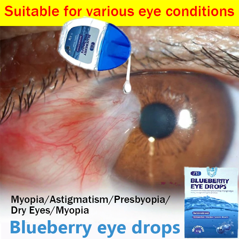 Obat mata katarak Blueberry Eye drop Obat mata merah Pengobatan mata rabun mata buram mata kering sa