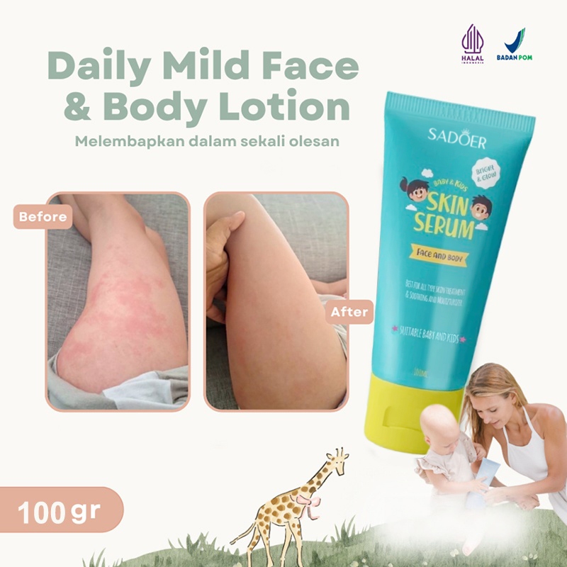 Glowby Skin Serum 2IN1 Face & Body Lotion 100ml Untuk Kulit Bayi dan Anak menghilangkan bekas luka