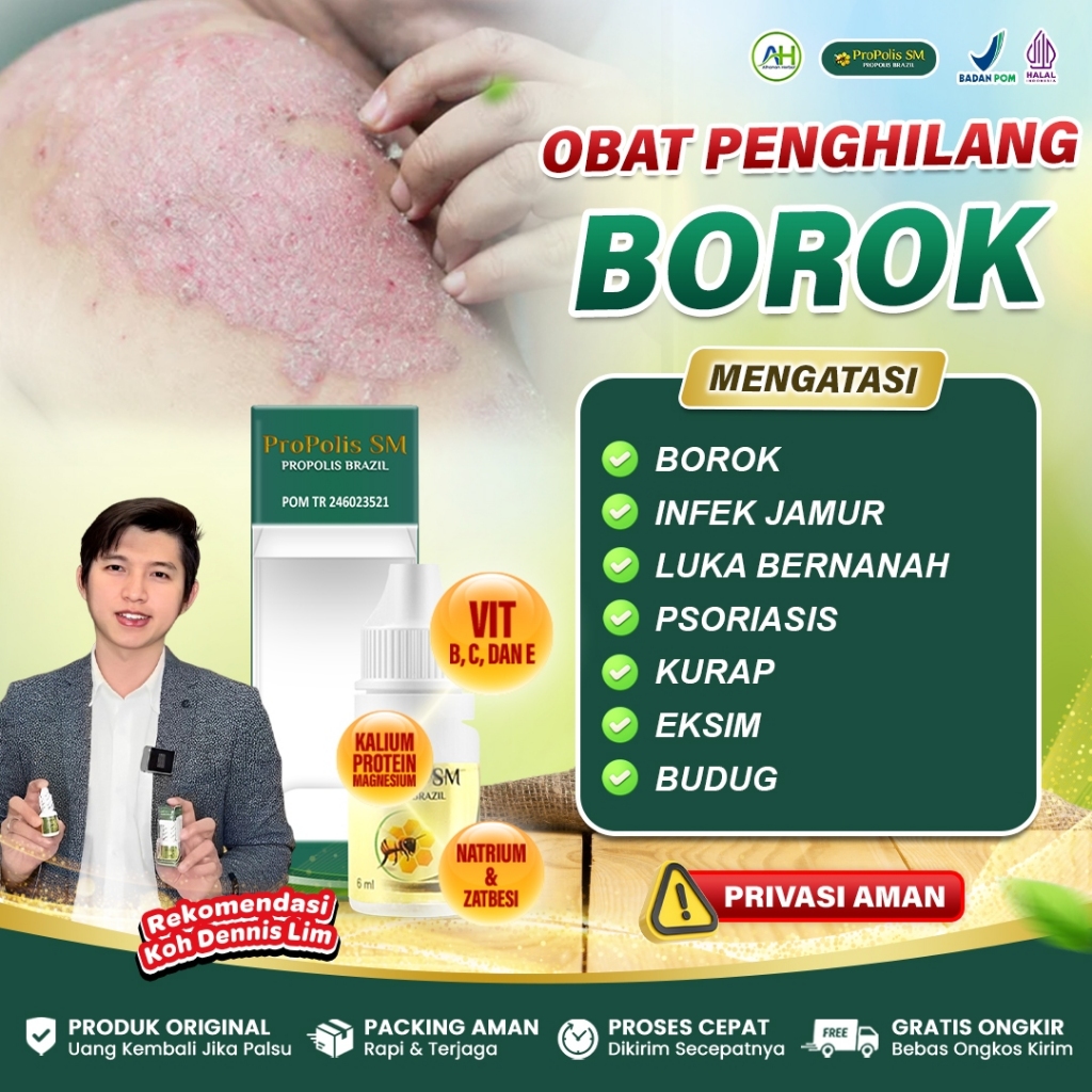 Obat Borok Biar Cepat Kering, Borok Bernanah Basah, Borok Di Kepala, Borok Di Kaki - Propolis SM