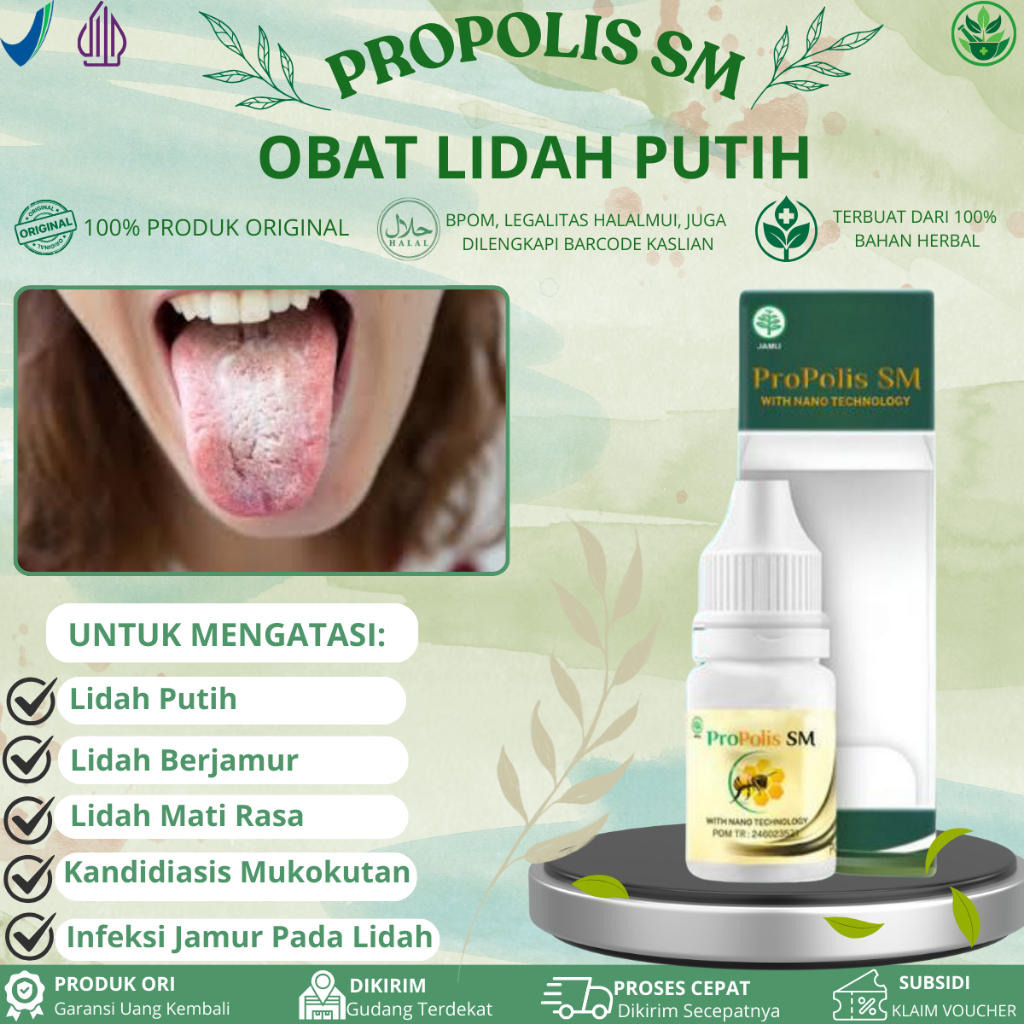 Obat Penghilang Lidah Putih, Lidah Berjamur, Lidah Jamuran, Bercak Putih Di Lidah, Kandidiasis Mukok