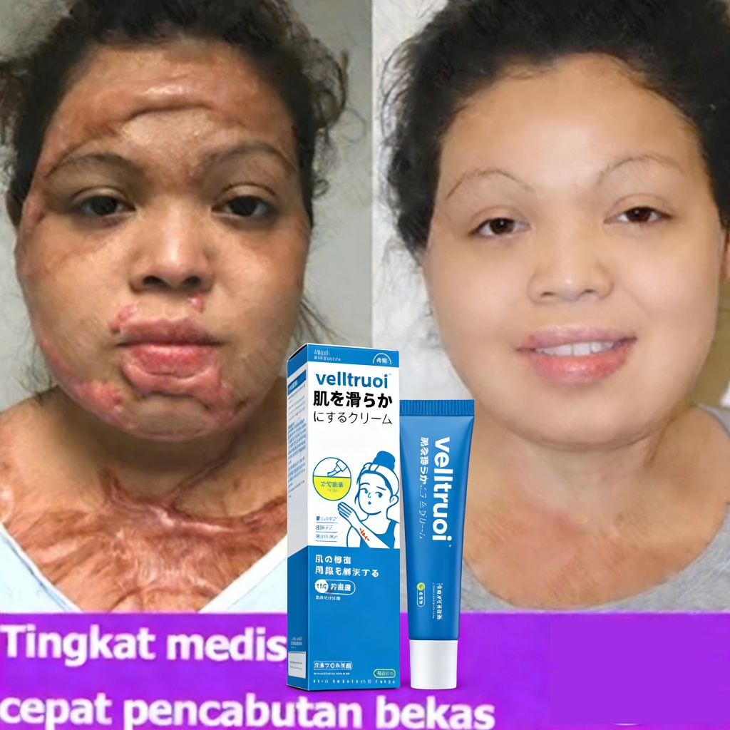 Penghilang bekas luka Penghilang bekas koreng hitam di kaki Penghilang Bekas cacar Bekas lama Bekas 