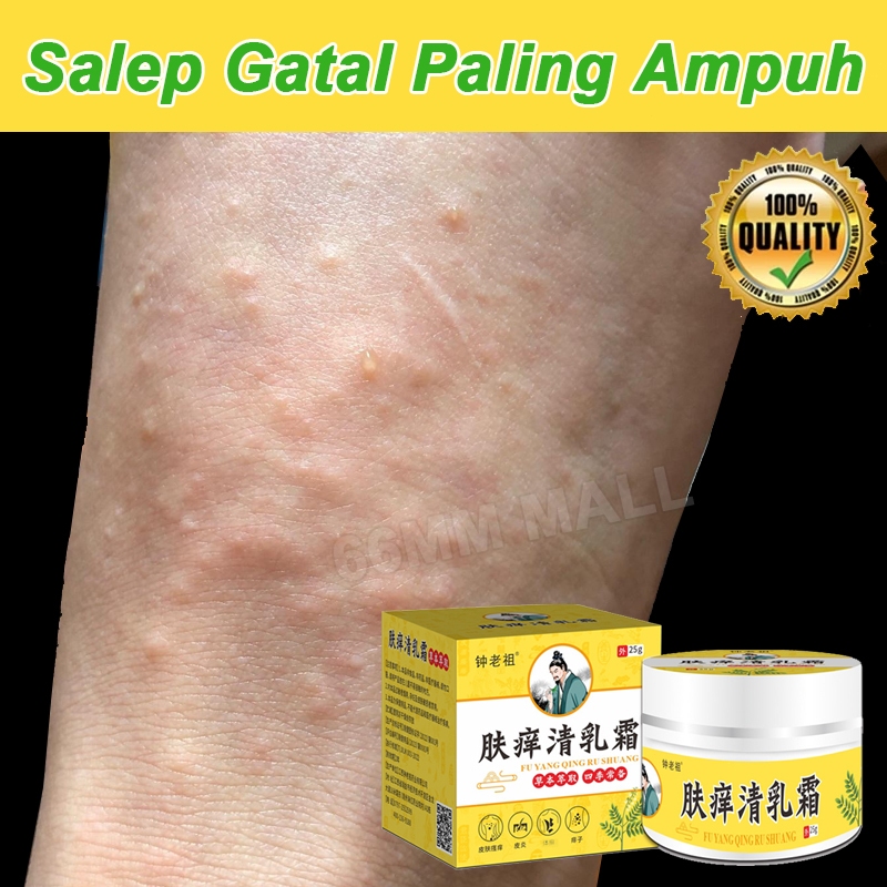 Salep Eksim Kering dan Gatal Salep Gatal China Paling Ampuh Bayi Salep Selangkangan Eksim Dan Jamur 