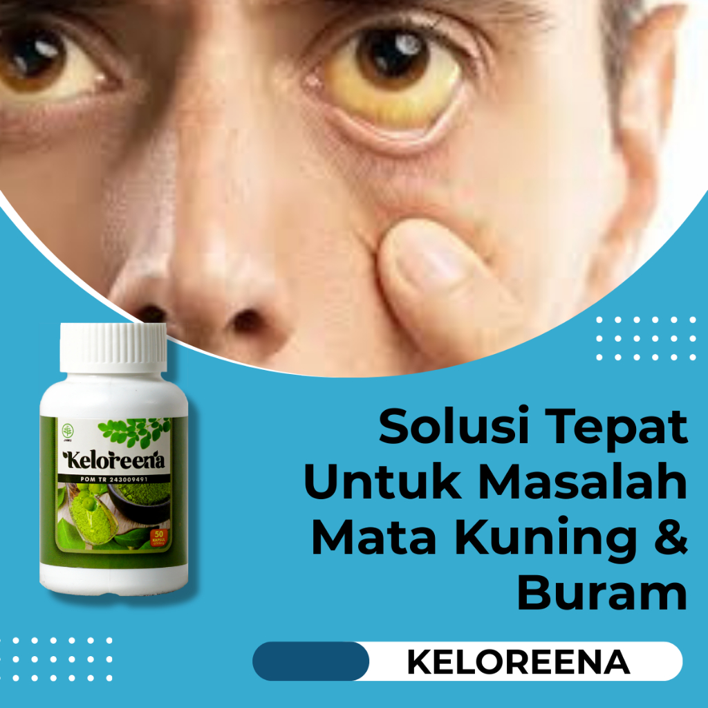Obat Mata Kuning Berlemak Mata Buram Vitamin Mata - Keloreena