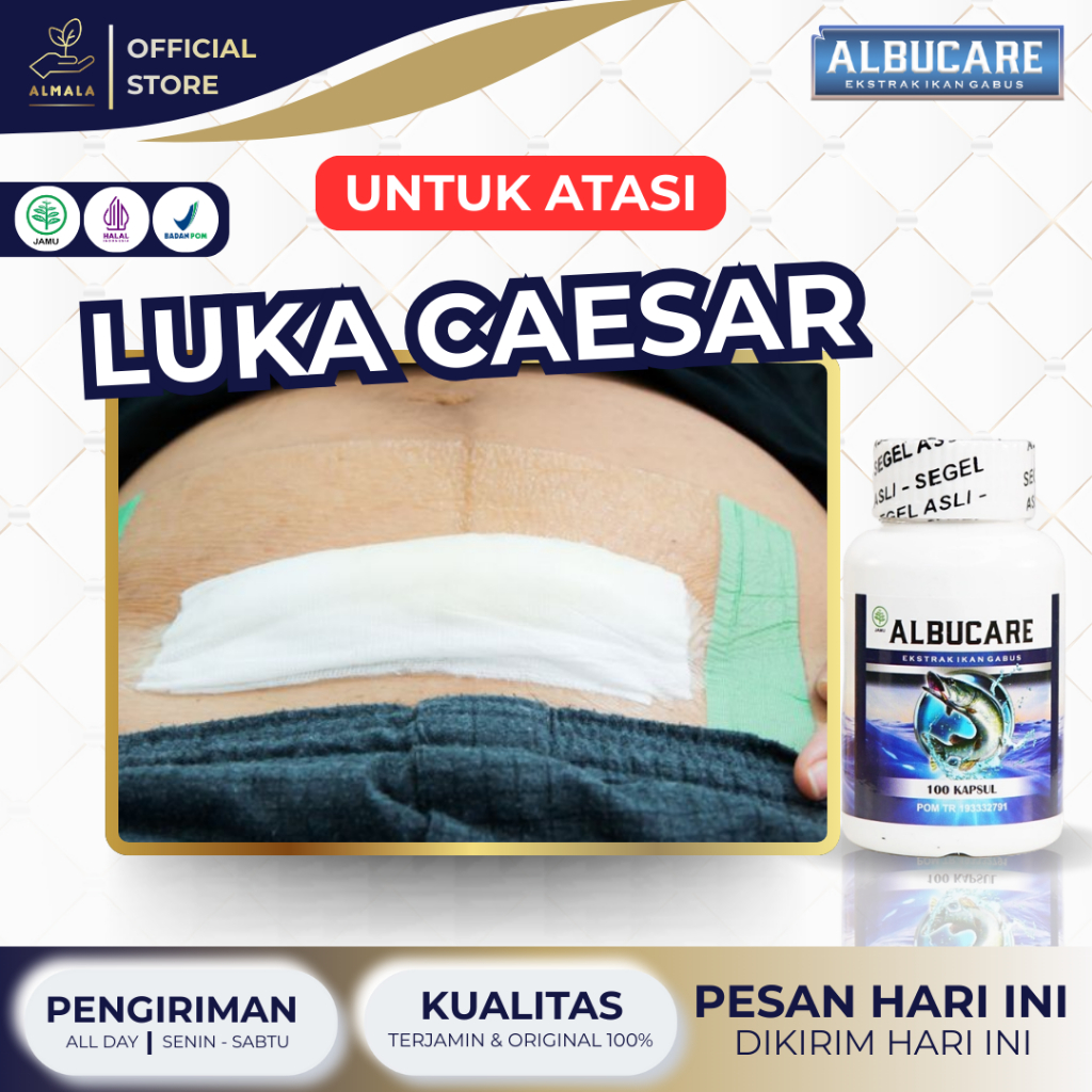 Obat Luka Caesar, Pasca Operasi Caesar, Pengering Luka Sesar, Pengering Luka Operasi, Bekas Operasi 