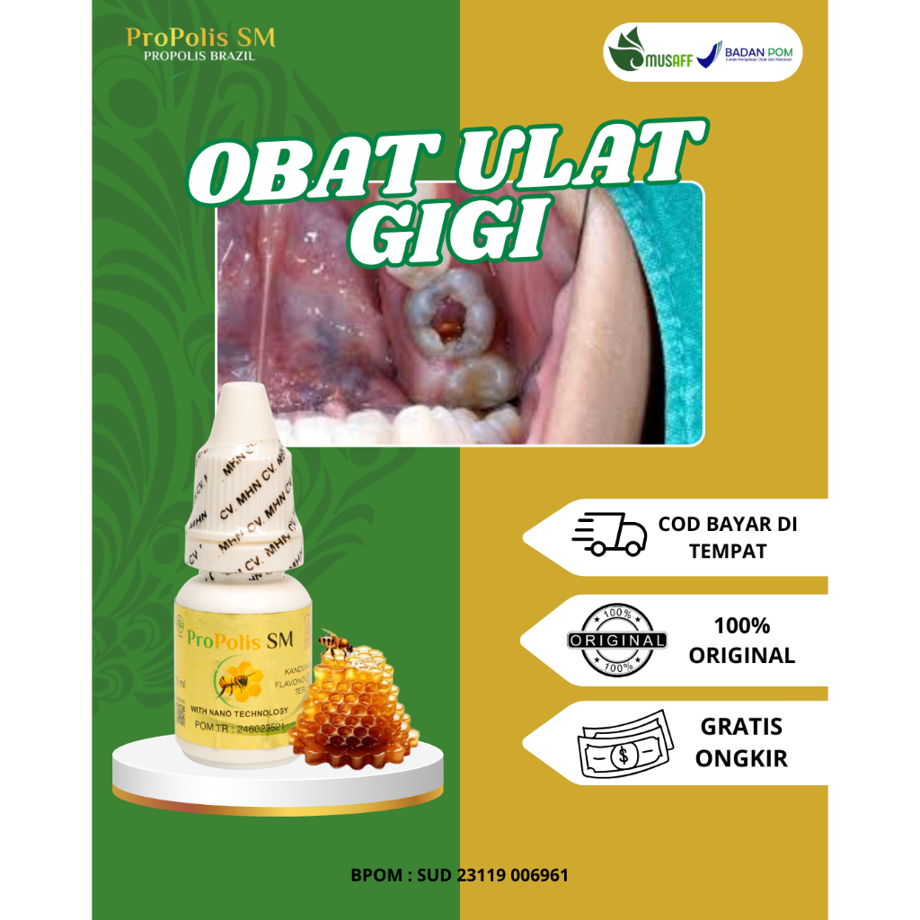 Obat Ulat Gigi, Obat Penghilang Ulat Gigi, Obat Sakit Gigi Keluar Ulat, Obat Untuk Ulat Gigi
