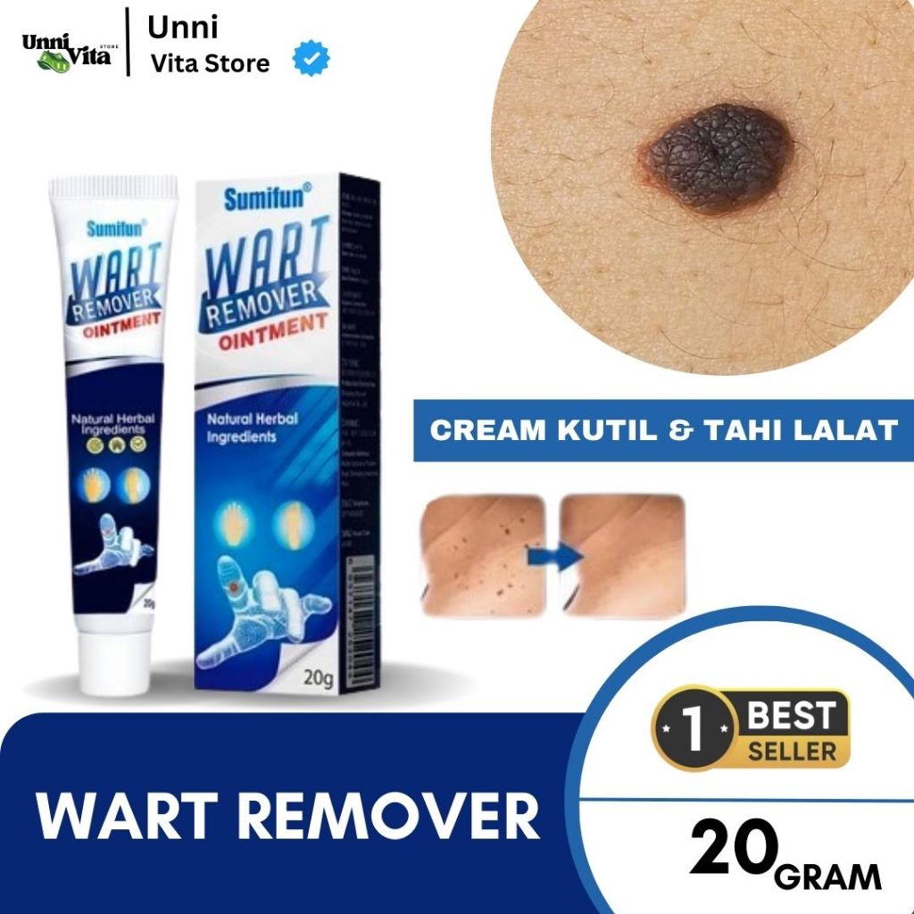 [ORI] Obat Penghilang Tahi Lalat | Obat Menghilangkan Tahi Lalat Isi 20gr Original