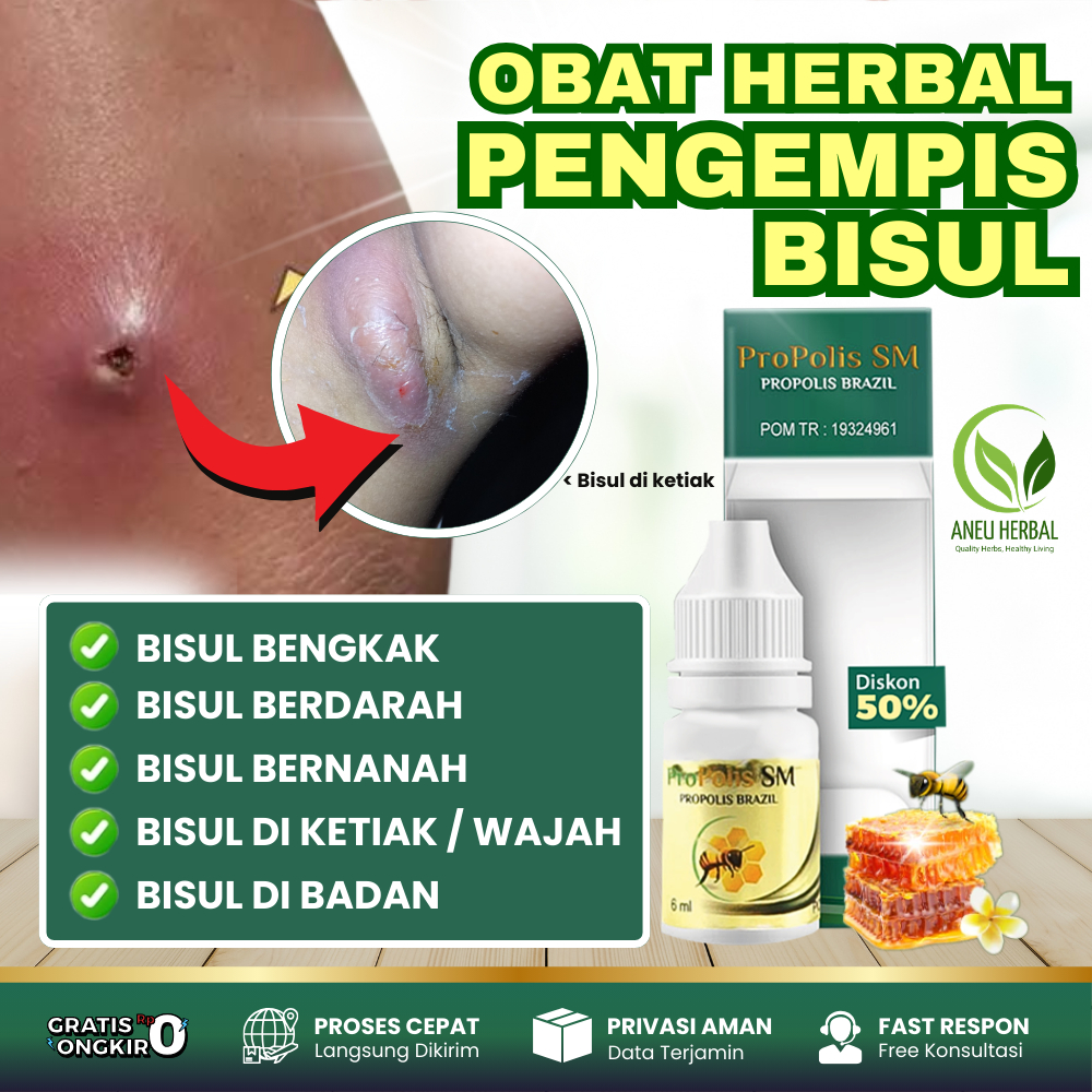 Propolis SM Salep Untuk Bisul Obat Bisul Bengkak Bisul Bernanah Bisul Berdarah Obat Bisul Di Ketiak 