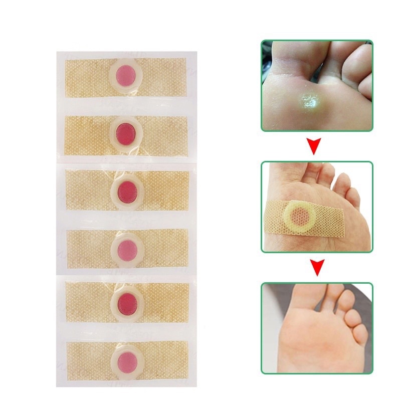 isi 6 Pcs Plester Kutil Mata Ikan Penghilang Kutil Penghilang Mata Ikan