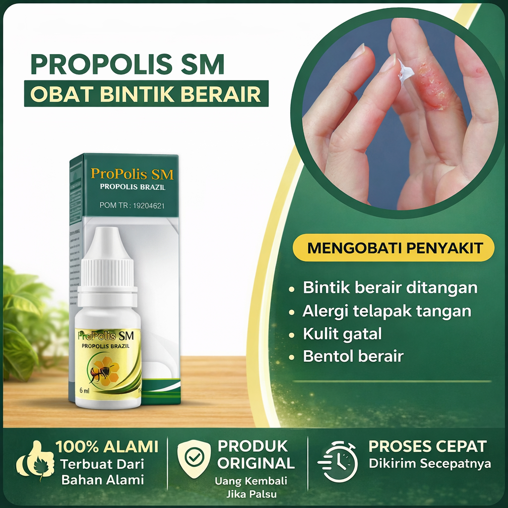 Propolis SM Original – Perawatan Kulit untuk Bintik Berair, Gatal & Iritasi di Tangan