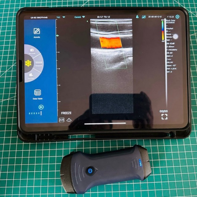 NEW USG PORTABLE WIRELESS WIRED CONVEX LINEAR CARDIAC ABDOMEN GYNECOLOGY OBGYN COLOR DOPPLER