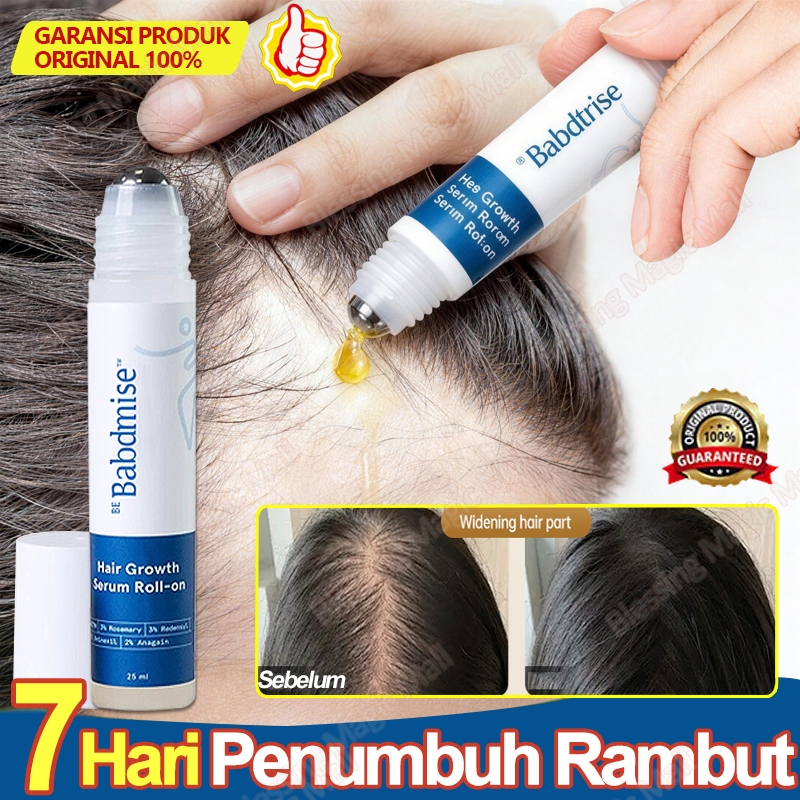 Penumbuh Rambut Cepat Dan Tebal Serum Rambut Roller Rosemary Oil Obat Rambut Rontok Serum Rambut Pel