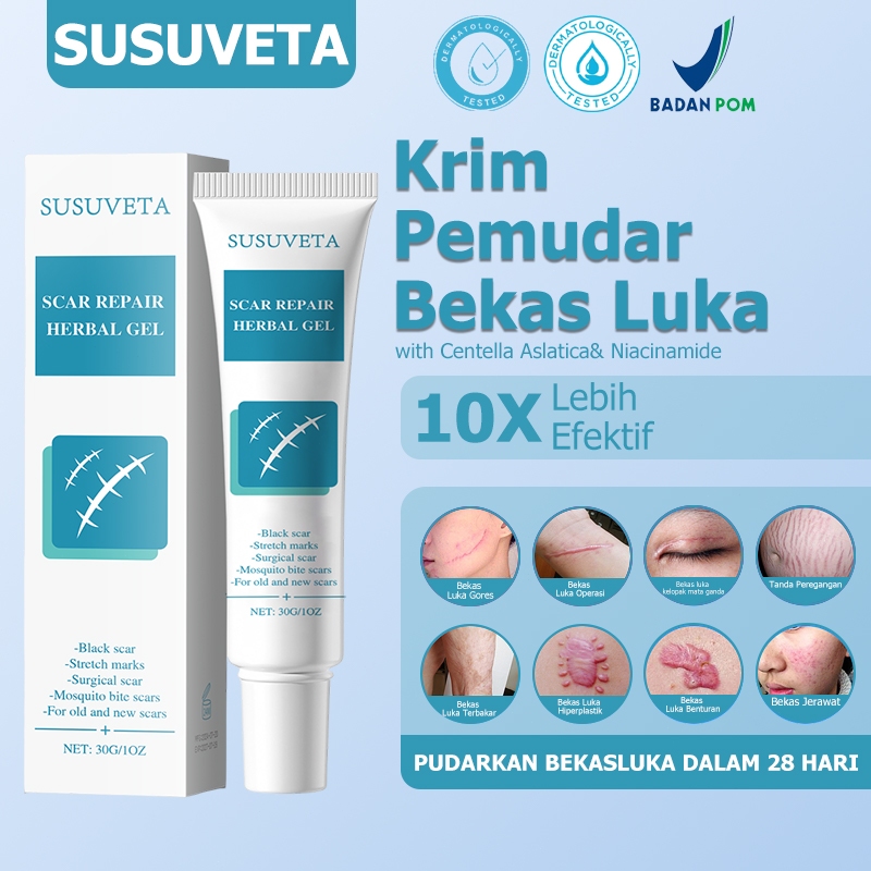 Penghilang bekas luka hitam koreng Obat penghilang bekas luka Penghilang bekas luka Salep penghilang