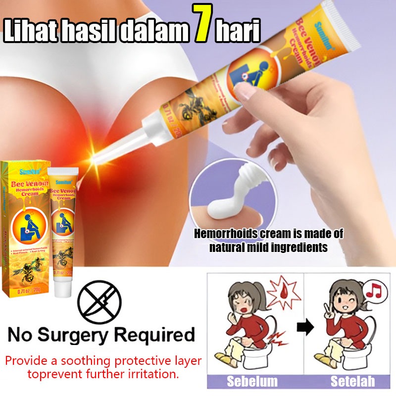 Salep ambeien Obat salep wasir Salep wasir Obat salep ambeien Obat salep ambeien Salep ambeien palin