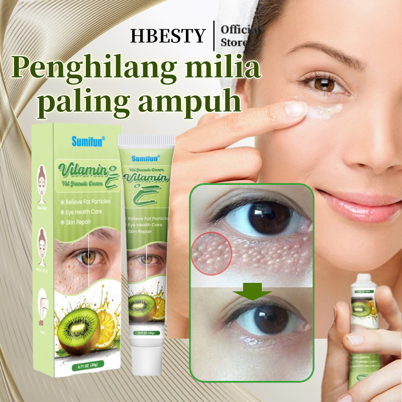 HBESTY Penghilang milia paling ampuh Penghilang milia Salep milia Penghilang milia di bawah mata Mil