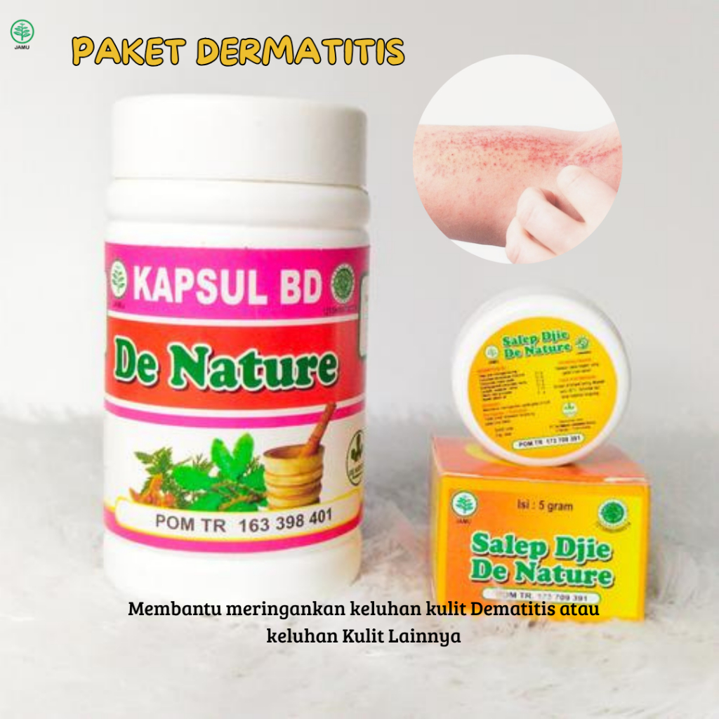 Salep gatal Salep dermatitis Salep kulit paling ampuh - Menghambat Jamur Dermatitis Anti Gatal
