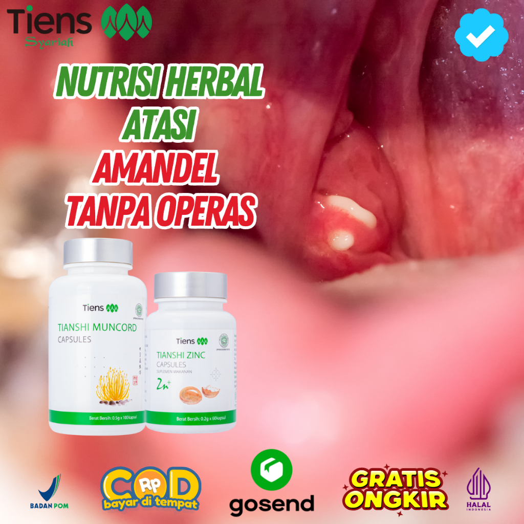Tiens Tcm Herbal China Amandel Sakit Radang Obat Tenggorokan Fitofarmaka Bpom Halal Original