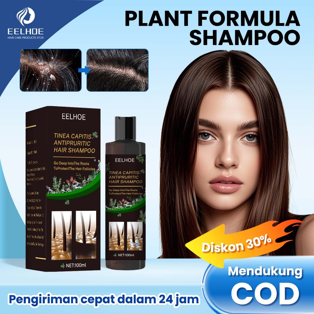 EELHOE Shampoo Psoriasis 100ml Shampoo Penghilang Ketombe Oil Control