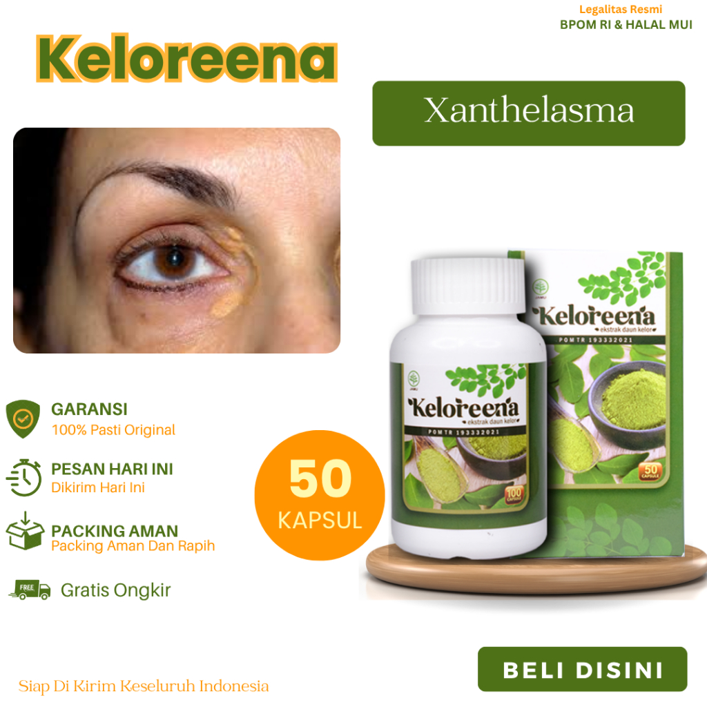 Obat Xanthelasma, Gumpalan Daging di Kelopak Mata, Plak Mata Kuning, Bintil Xanthelasma, Benjolan Xa