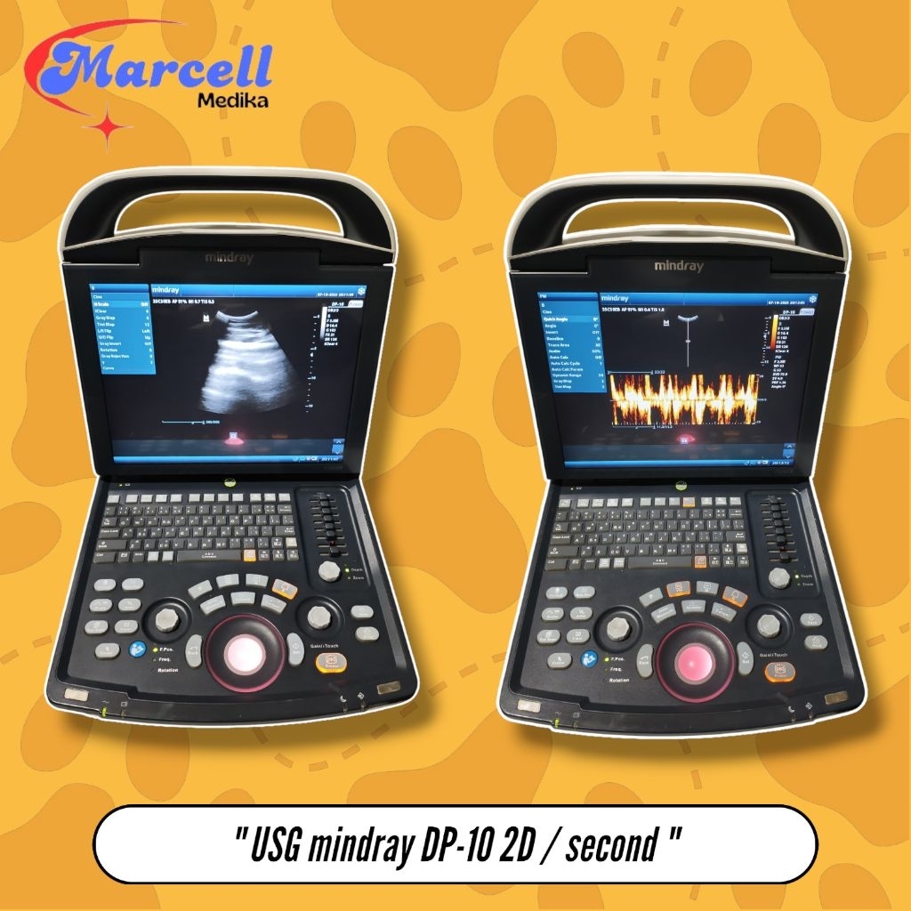 USG MINDRAY DP-10 2D DOPPLER / ALAT CEK USG MINDRAY DP-10 second
