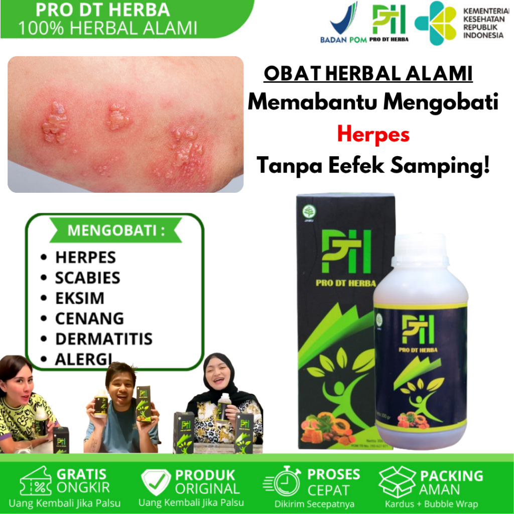 Obat Herpes Herpes Kelamin Herpes Bibir Herpes Genital Herpes Zoster Obat Herpes