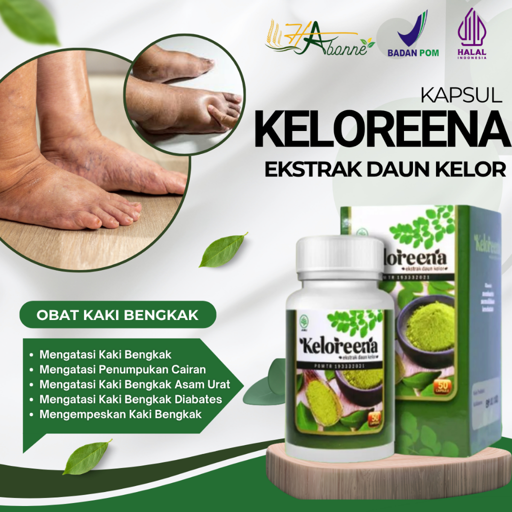 Obat Kaki Bengkak Akibat Penumpukan Cairan Edema Kaki Bengkak Asam Urat Diabetes Pengempis Kaki Beng