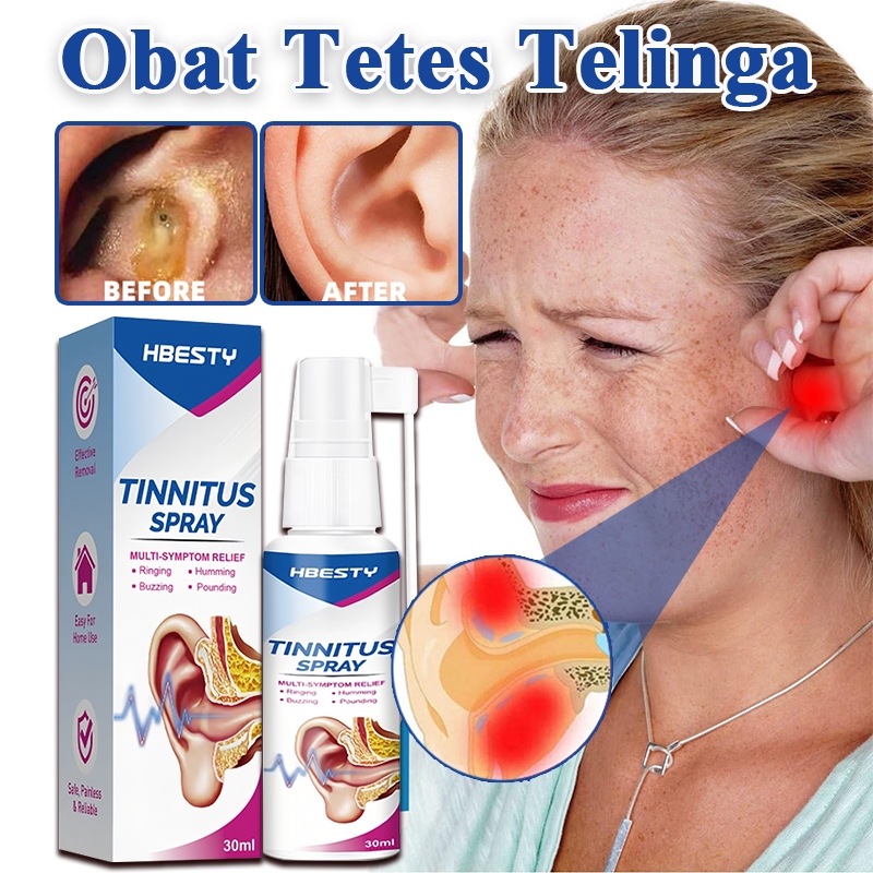 tetes telinga pembersih kotoran pembersih telinga bayi meringankan telinga gatal cairan pembersih te