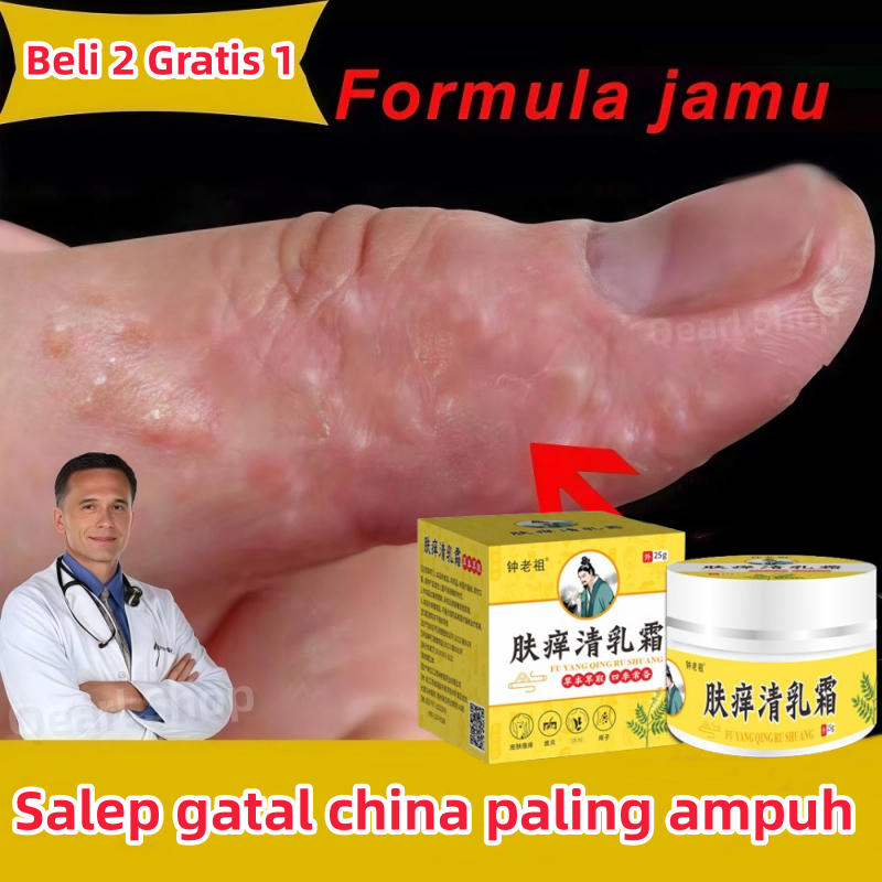 salep gatal china paling ampuh original cream eksim psoriasis obat gatal selangkangan dan hitam krim