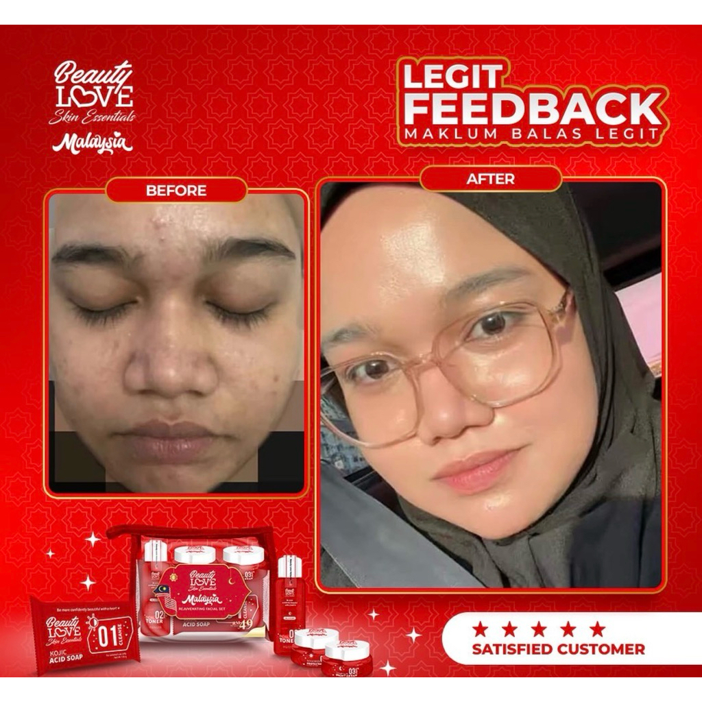 TERMURAH PAKET LENGKAP KRIM CREAM SET BEAUTYLOVE BL MALAYSIA BEAUTY LOVE JAMINAN ORIGINAL ASLI REJUV