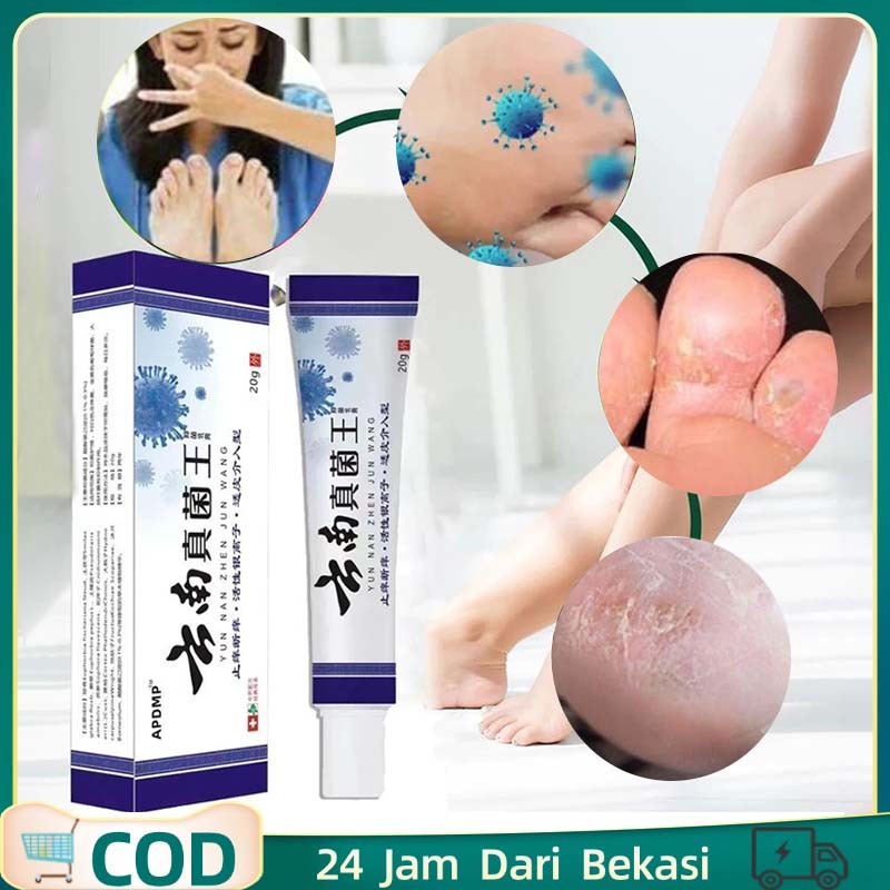 Salep Kaki Rayapan Dan Bau Salep Kaki Obat Kaki Rayapan Dan Bau Obat Telapak Kaki