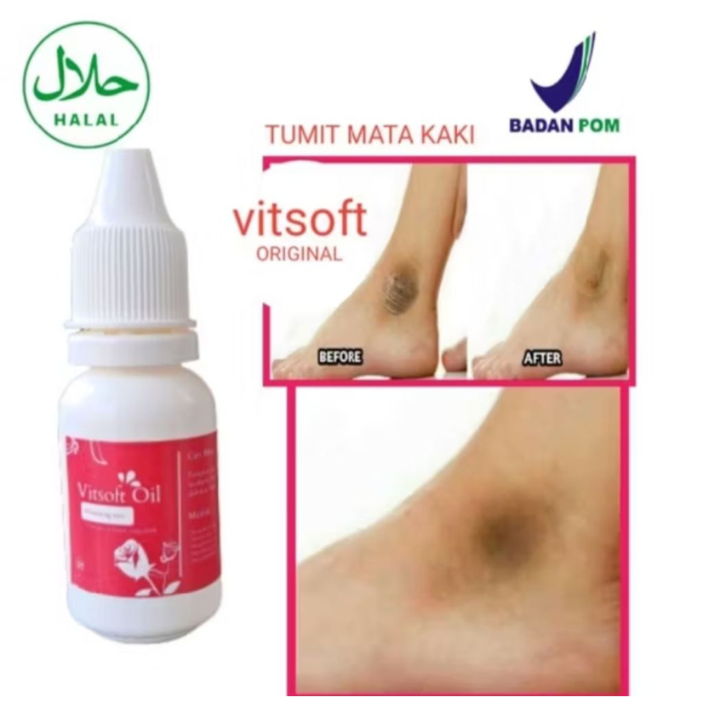 PEMUTIH TUMIS MATA KAKI VITSOFT ORIGINAL