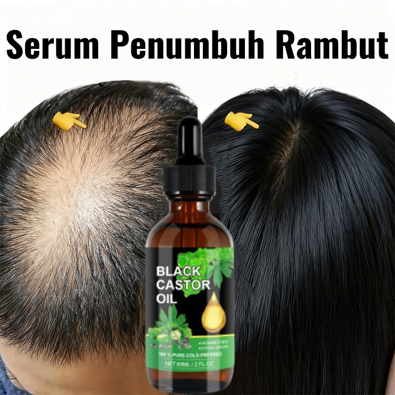 Obat penumbuh rambut Rambut rontok Pelebat rambut anak rambut rontok Penumbuh rambut botak Obat penu