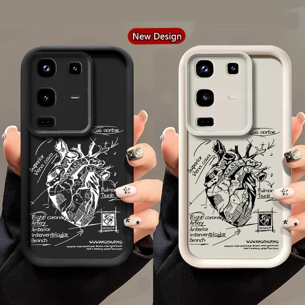 Softcase Rubber Infinix NOTE 50 50X 50X NOTE 50 PRO - Case Hp Infinix NOTE 50 50X 50X NOTE 50 PRO - 