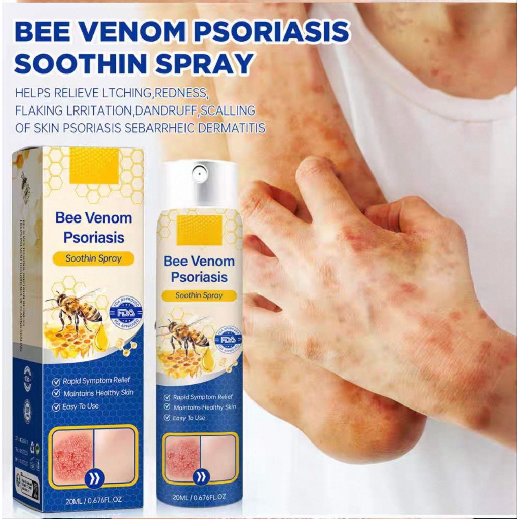 Psoriasis Spray Anti Psoriasis Jamur Bakteri