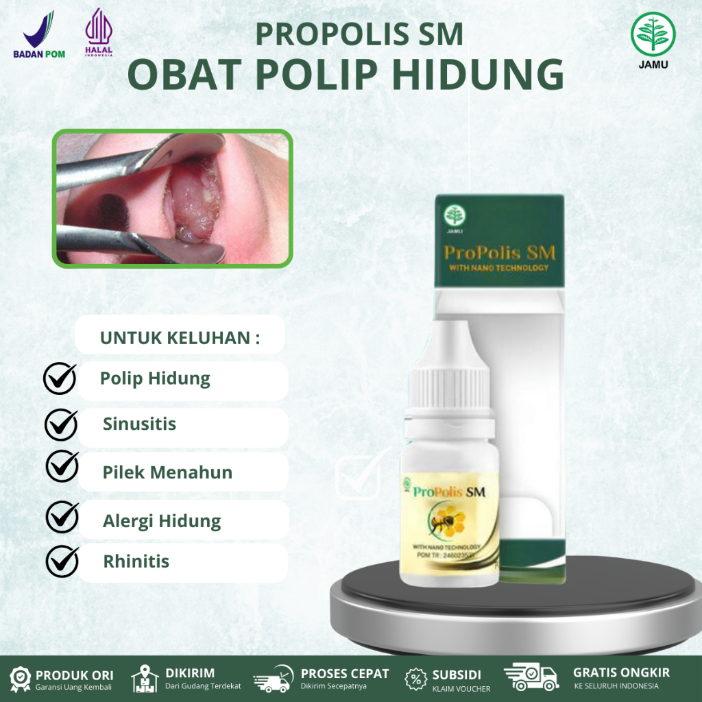 Propolis SM untuk Polip Hidung Sinusitis Benjolan Dalam Hidung, Pilek Menahun, Hidung Tidak Bisa Men