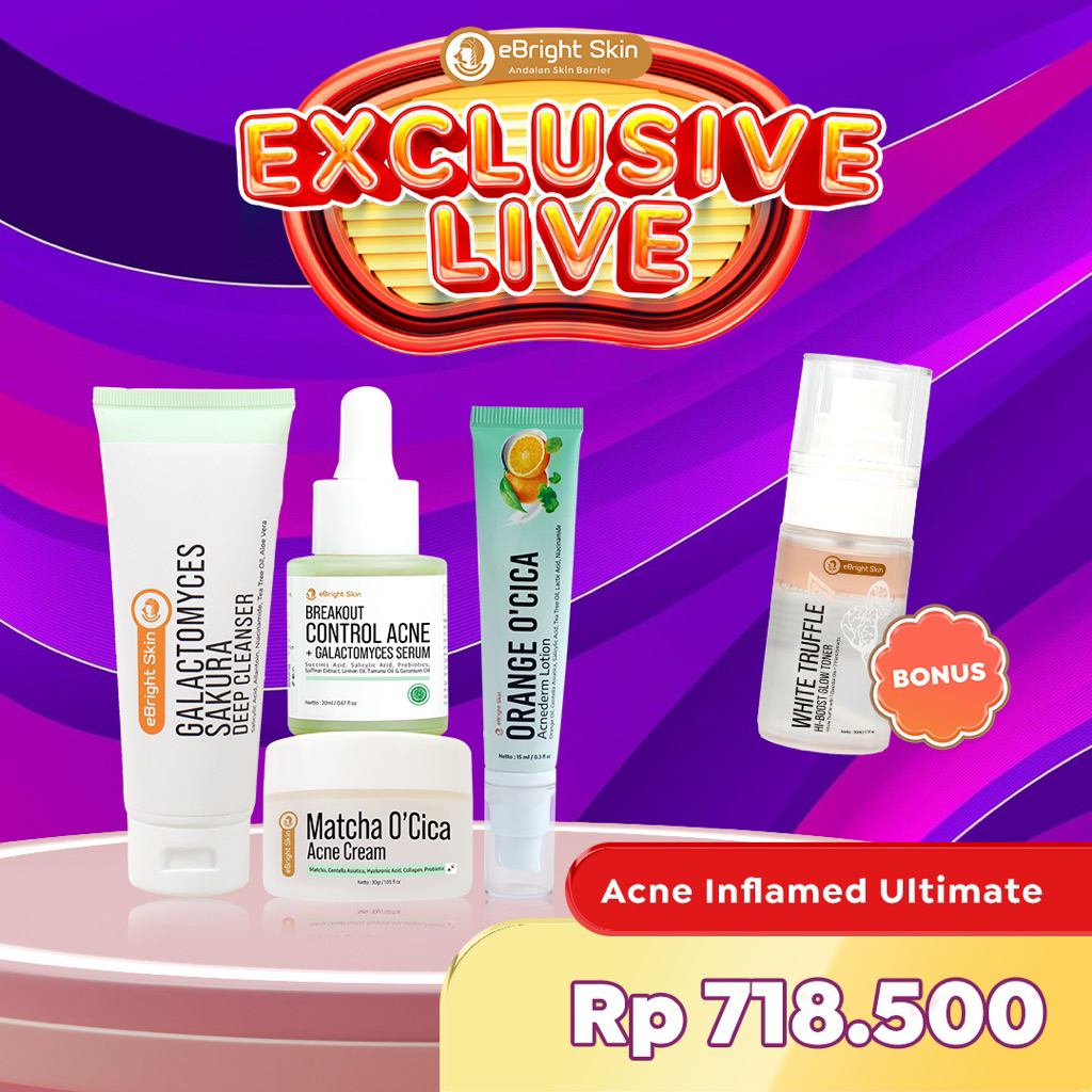 eBright Skin Paket Jerawat Meradang - Acne Inflamed Ultimate