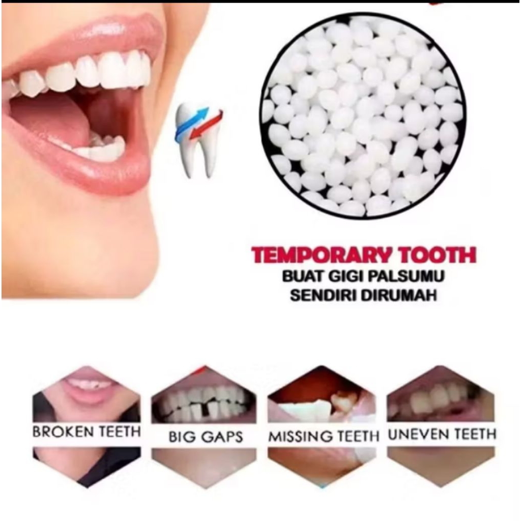 Temptooth Penambal Gigi Sementara Mudah Dibentuk Sendiri di Rumah