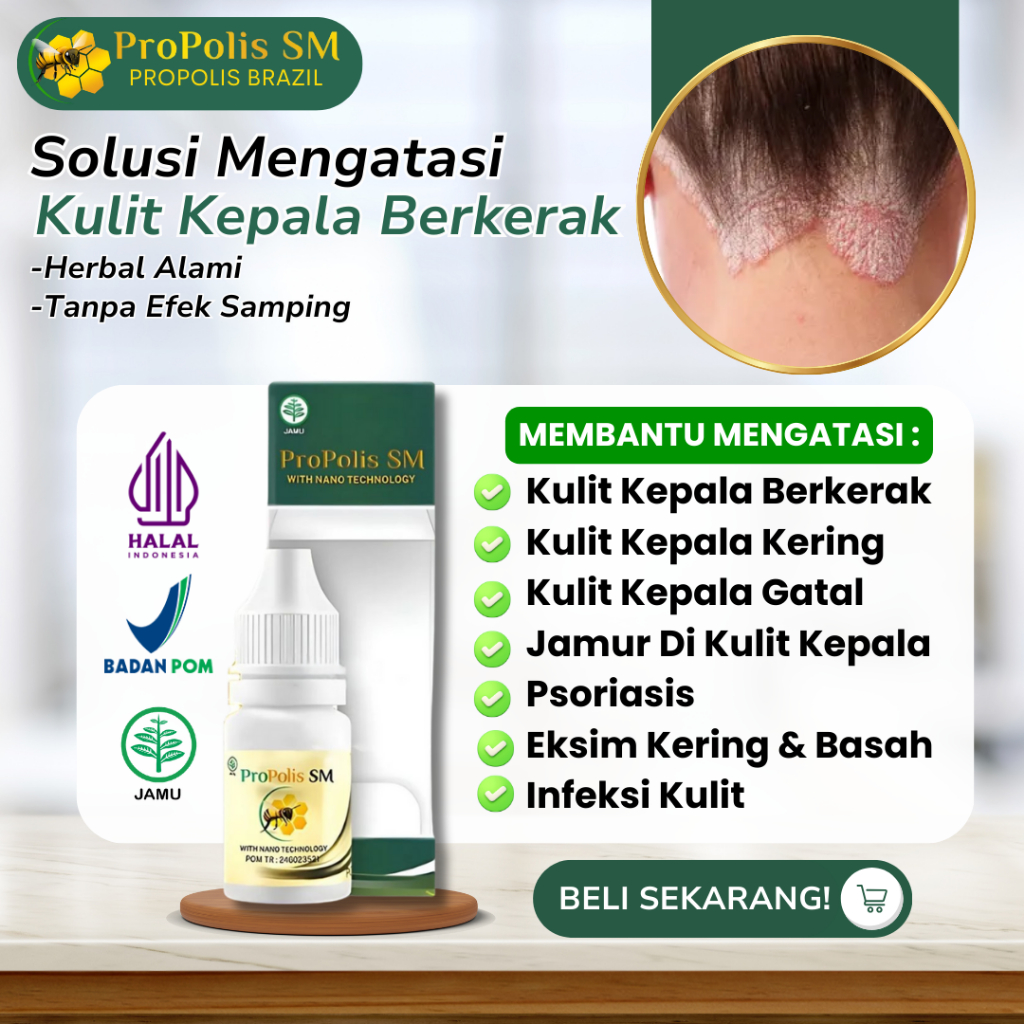 (BISA COD) Obat Oles Tetes Kulit Kepala Berkerak Bersisik Mengelupas, Obat Kulit Kepala Kering, Obat