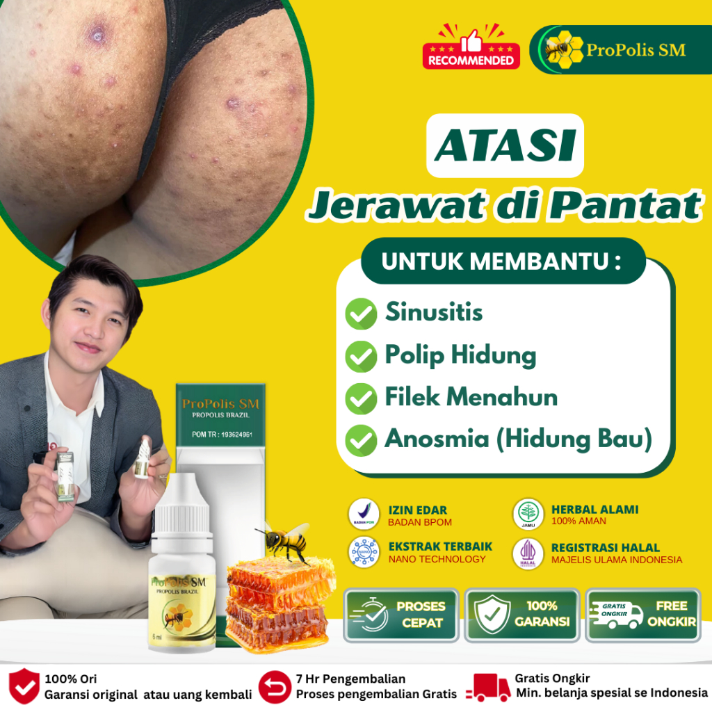 Obat Gatal Pantat|Obat Oles Pantat Burik|Obat gatal di pantat|penghilang gatal beruntusan di pantat|
