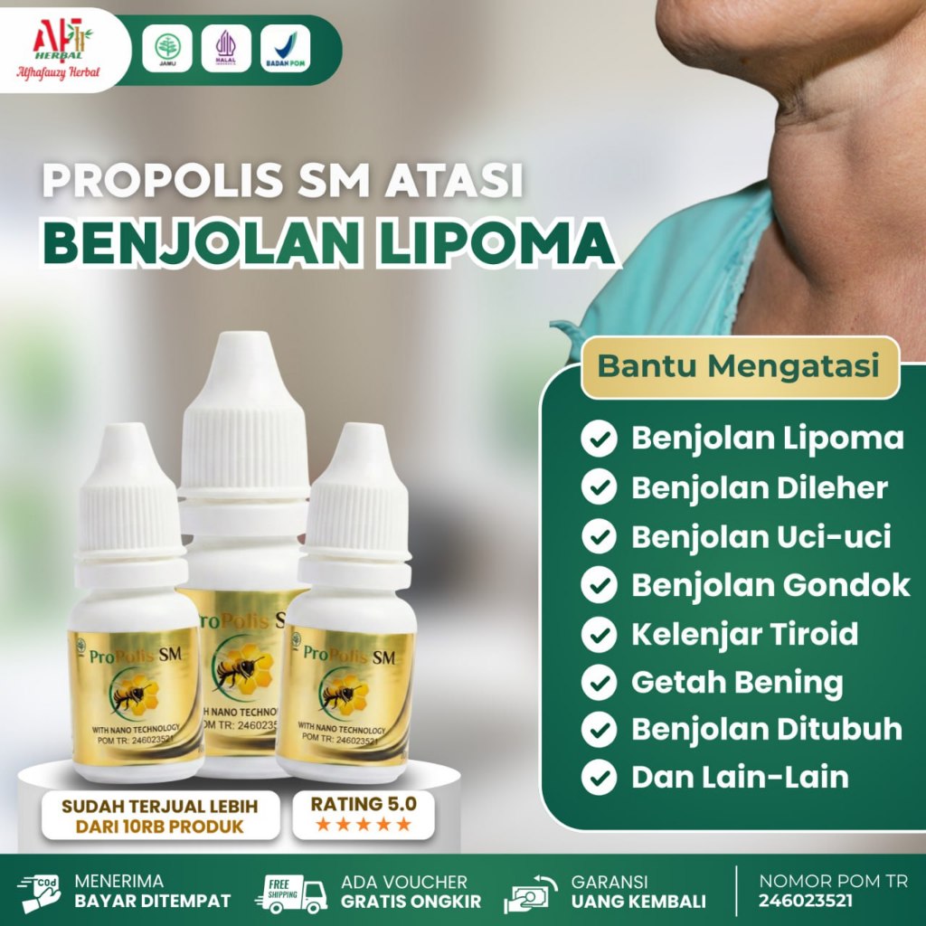 Obat Lipoma - Benjolan Besar - Benjolan Kecil Di Tubuh Leher Kepala Dahi Tangan Propolis Sm brazil O