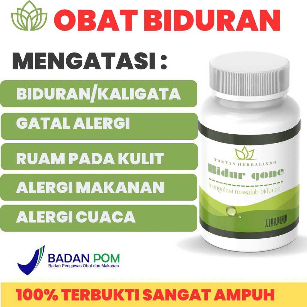 OBAT BIDURAN ALERGI DINGIN ALERGI MAKANAN
