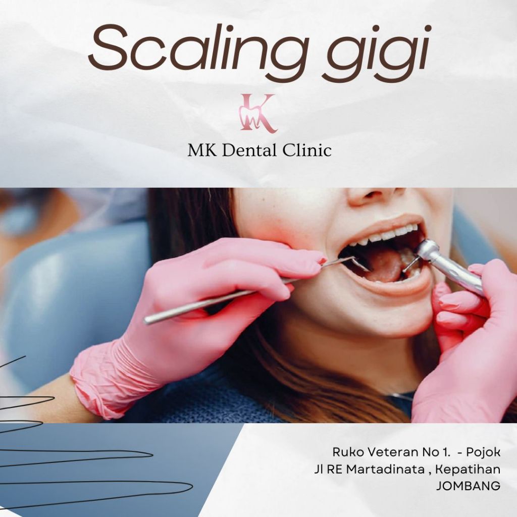 Scaling gigi ( rahang bawah & rahang atas )