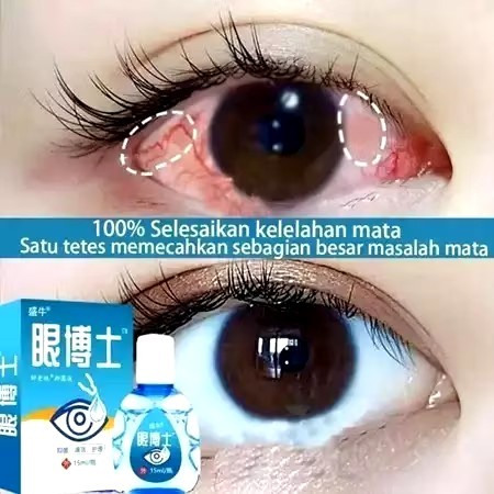 EYE DROP JAPAN DEWASA DAN ANAK Tetes Mata Japan Mata Katarak Mata Minus Mata silinder Mata Merah Mat
