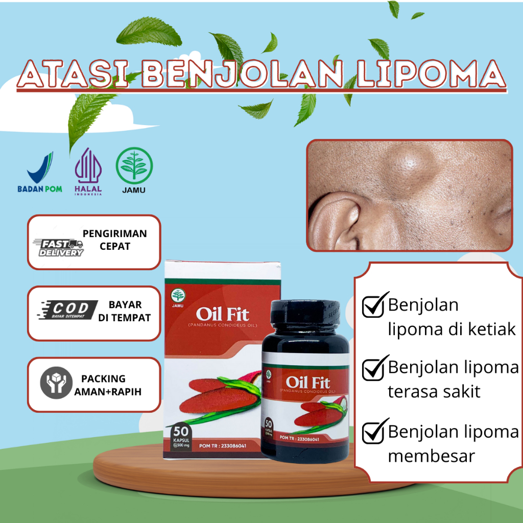 Obat minum untuk benjolan lipoma terasa nyeri & membesar, Benjolan lipoma di kepala-Oil Fit
