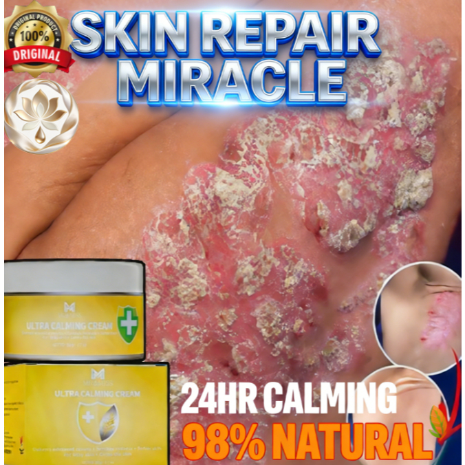 obat gatal salep china salap gatal kulit yang ampuh salep china gatal paling ampuh salep panu gatal 